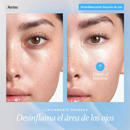 Gel Contorno de Ojos Belif Aqua Bomb Revitalizante 15 ML